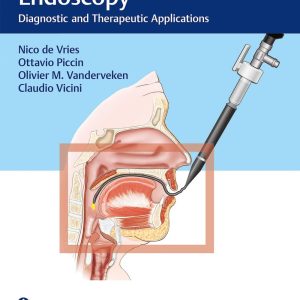 Drug Induced Sleep Endoscopy  Diagnostic and Therapeutic Applications First Edition