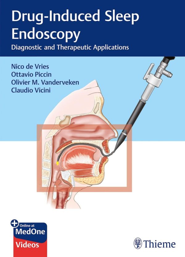 Drug Induced Sleep Endoscopy  Diagnostic and Therapeutic Applications First Edition