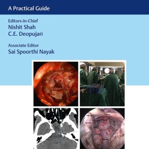 Endoscopic Transsphenoidal Surgery: A Practical Guide First Edition