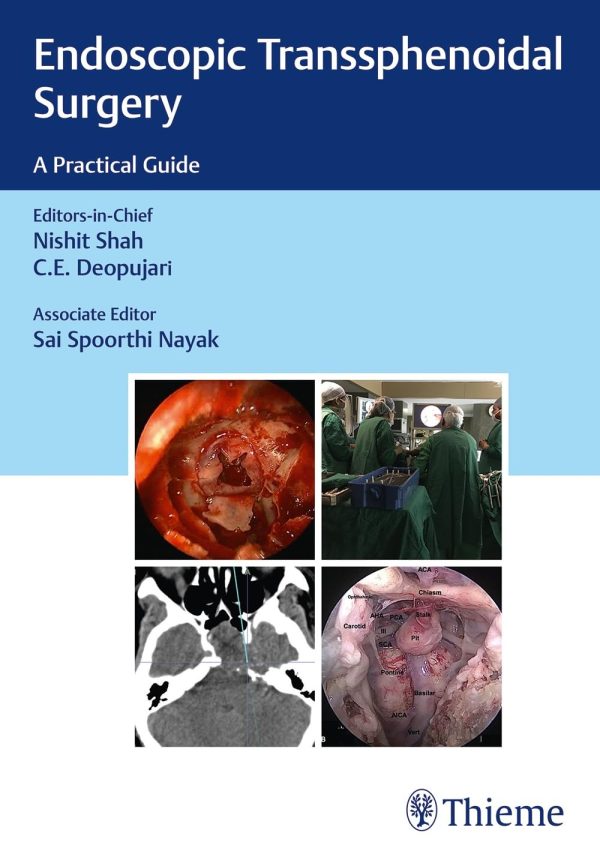 Endoscopic Transsphenoidal Surgery: A Practical Guide First Edition