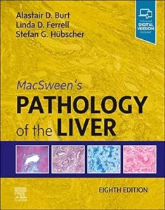 MacSween’s Pathology of the Liver Eighth Edition
