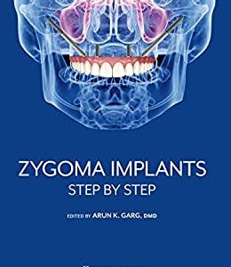 Zygoma Implants: Step by Step First Edition