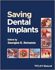 Saving Dental Implants First Edition