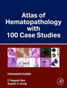 Atlas of Hematopathology with 100 Case Studies 1st Edition