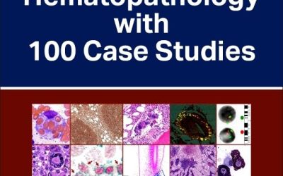 Atlas of Hematopathology with 100 Case Studies 1st Edition