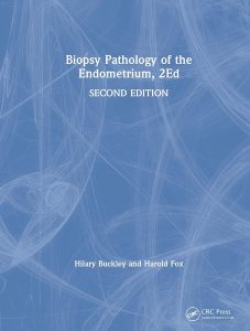 Biopsy Pathology of the Endometrium 2nd Edition