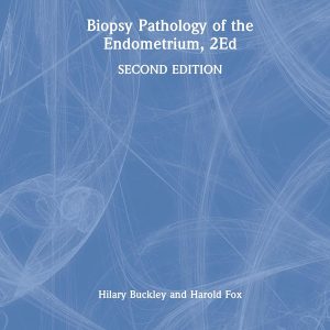 Biopsy Pathology of the Endometrium 2nd Edition