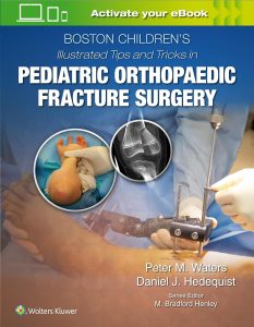 Boston Children’s Illustrated Tips and Tricks in Pediatric Orthopaedic Fracture Surgery First Edition