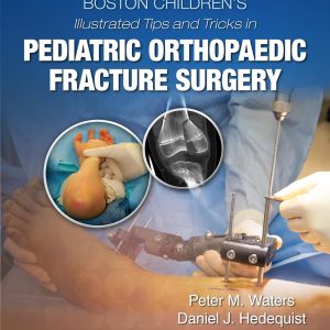 Boston Children’s Illustrated Tips and Tricks in Pediatric Orthopaedic Fracture Surgery First Edition