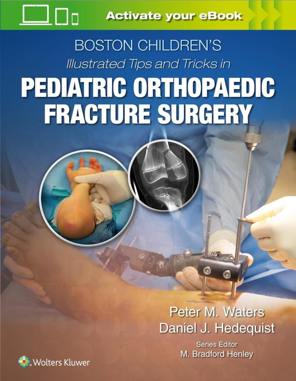 Boston Children’s Illustrated Tips and Tricks in Pediatric Orthopaedic Fracture Surgery First Edition