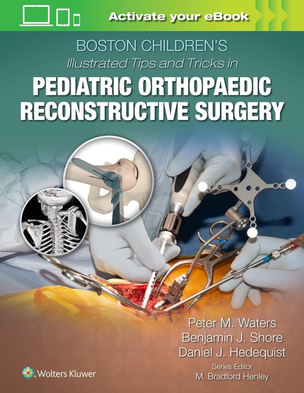 Boston Children’s Illustrated Tips and Tricks in Pediatric Orthopaedic Reconstructive Surgery 1st Edition