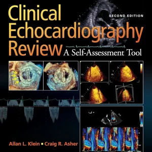 Clinical Echocardiography Review 2nd Edition