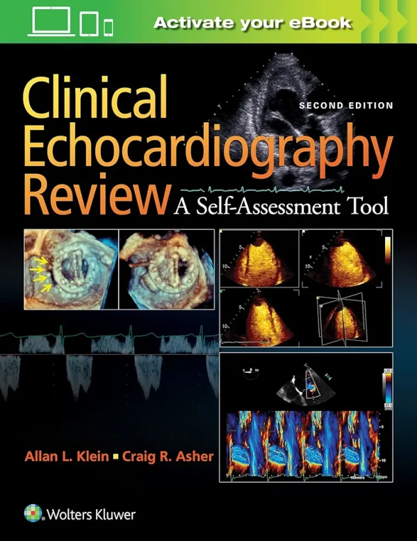 Clinical Echocardiography Review 2nd Edition