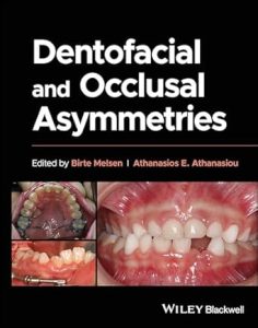 Dentofacial and Occlusal Asymmetries, 1st Edition