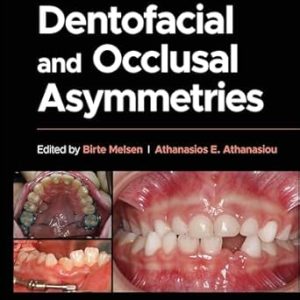 Dentofacial and Occlusal Asymmetries, 1st Edition