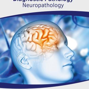 Diagnostic Pathology: Neuropathology by Josh Vaughan