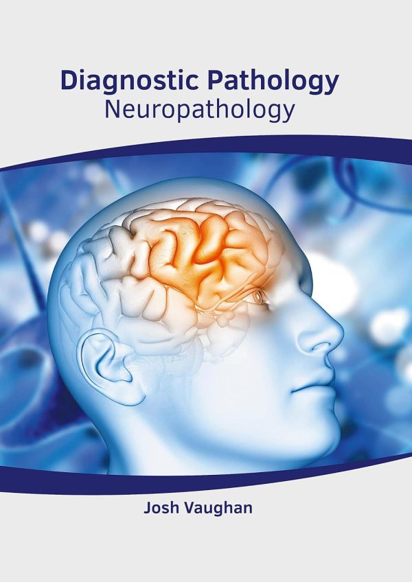 Diagnostic Pathology: Neuropathology by Josh Vaughan