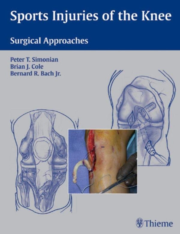 Sports Injuries of the Knee: Surgical Approaches