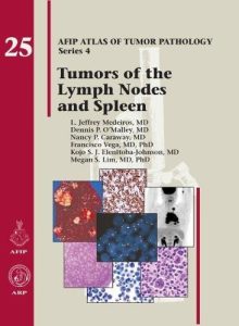 Tumors of the Lymph Nodes and Spleen (AFIP Atlas of Tumor Pathology Series 4, Vol. 25)
