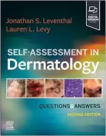 Self-Assessment In Dermatology Question And Answers Second Edition