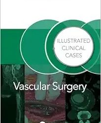 Vascular Surgery  Illustrated Clinical Cases First Edition