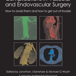 Complications in Vascular and Endovascular Surgery: How to Avoid Them and How to Get Out of Trouble First Edition