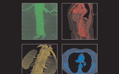 Complications in Vascular and Endovascular Surgery: How to Avoid Them and How to Get Out of Trouble First Edition