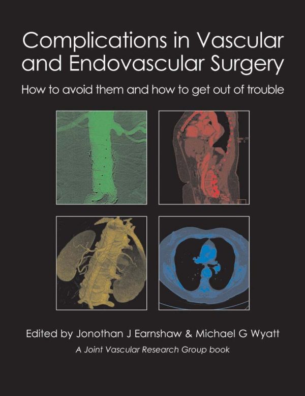 Complications in Vascular and Endovascular Surgery: How to Avoid Them and How to Get Out of Trouble First Edition