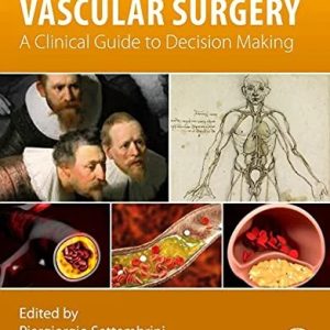 Neurosurgery Updates: Controversies in Vascular Surgery First Edition