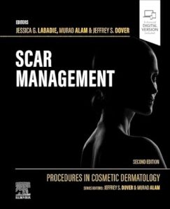 Scar Management Procedures in Cosmetic Dermatology Second Edition