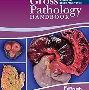 Gross Pathology Handbook: A Guide to Descriptive Terms Second Edition