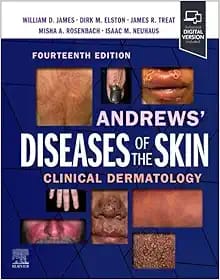 Andrews’ Diseases of the Skin  Clinical Dermatology Fourteenth Edition