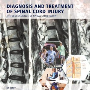 Diagnosis and Treatment of Spinal Cord Injury st Edition