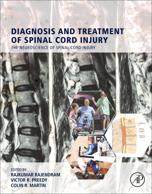 Diagnosis and Treatment of Spinal Cord Injury st Edition