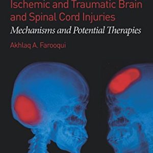 Ischemic and Traumatic Brain and Spinal Cord Injuries Mechanisms and Potential Therapies First Edition