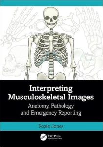 Interpreting Musculoskeletal Images Anatomy Pathology and Emergency Reporting First Edition