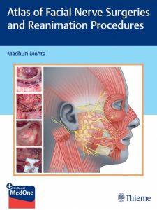 Atlas of Facial Nerve Surgeries and Reanimation Procedures First Edition