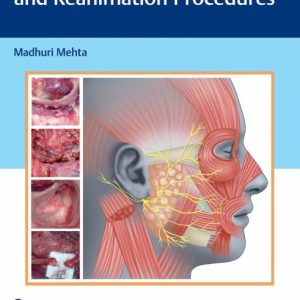 Atlas of Facial Nerve Surgeries and Reanimation Procedures First Edition