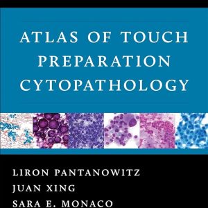 Atlas of Touch Preparation Cytopathology First Edition