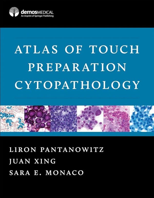 Atlas of Touch Preparation Cytopathology First Edition