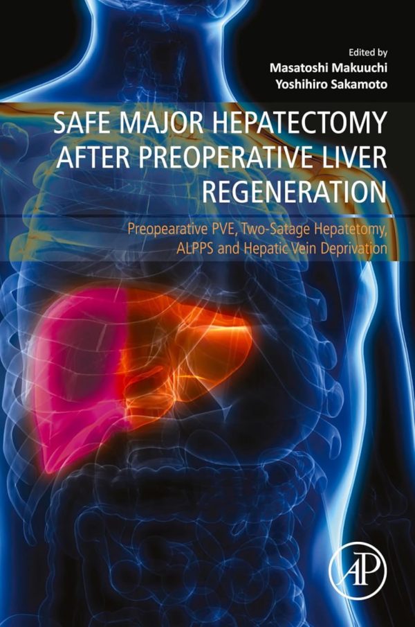 Safe Major Hepatectomy after Preoperative Liver Regeneration Preopearative PVE  Two Satage Hepatetomy ALPPS and Hepatic Vein Deprivation First Edition