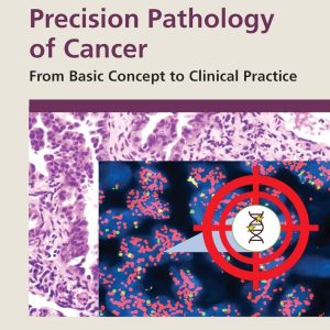 Precision Pathology of Cancer  From Basic Concept to Clinical Practice First Edition