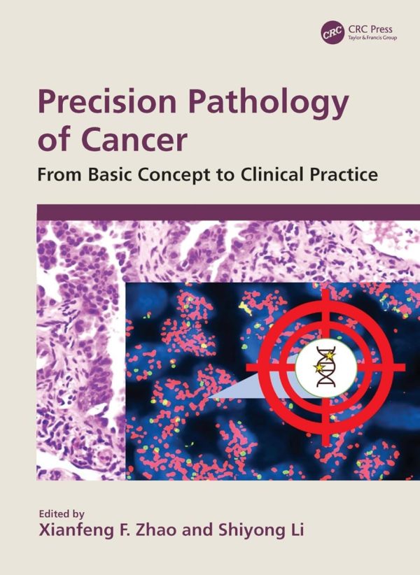 Precision Pathology of Cancer  From Basic Concept to Clinical Practice First Edition