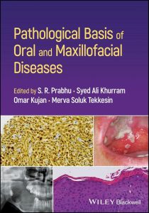 Pathological Basis of Oral and Maxillofacial Diseases First Edition