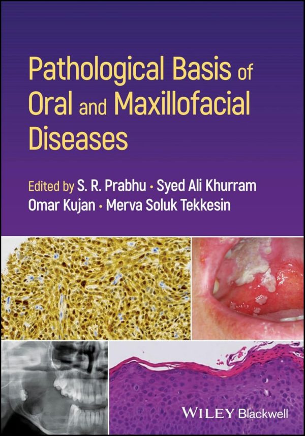 Pathological Basis of Oral and Maxillofacial Diseases First Edition