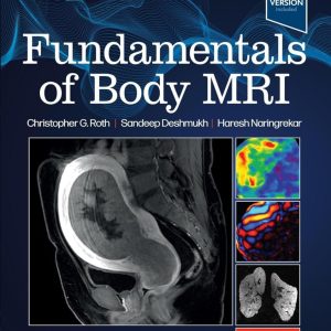 Fundamentals of Body MRI Fundamentals of Radiology Third Edition