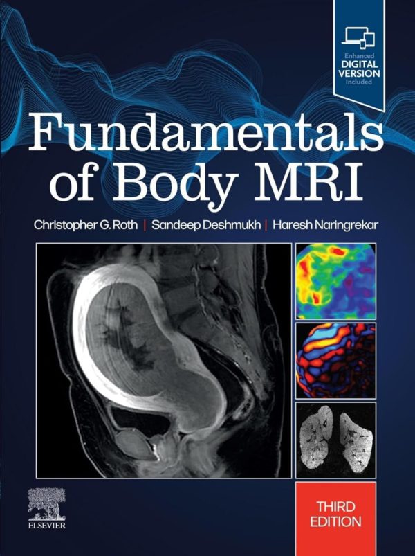 Fundamentals of Body MRI Fundamentals of Radiology Third Edition