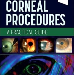 In-Office Corneal Procedures A Practical Guide First Edition