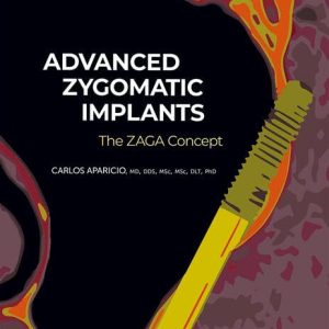 Advanced Zygomatic Implants: The Zaga Concept First Edition