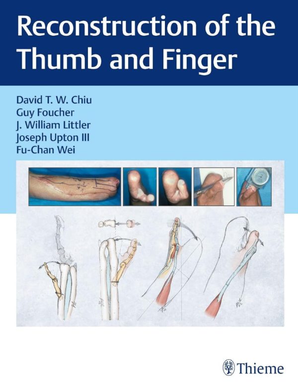 Reconstruction of the Thumb and Finger First Edition